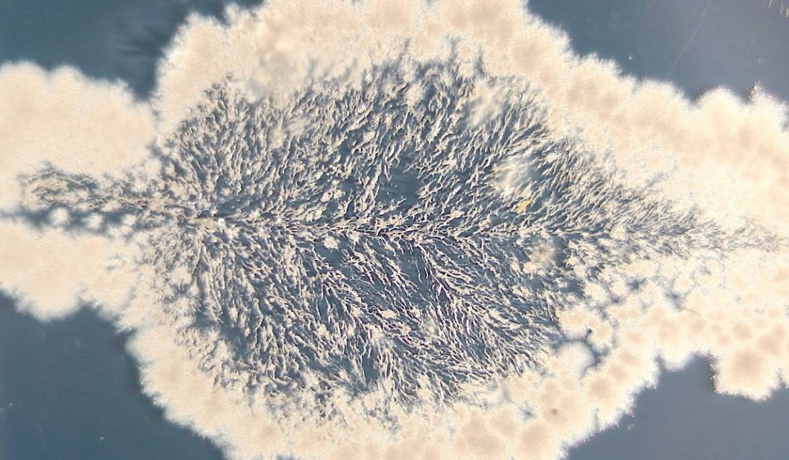 Visualisation de micro-organismes qui ont poussé sur milieu gélosé de type KB en boîte de Petri, trois jours après l’impression d’une feuille jeune et sans symptômes d’un plant femelle de kiwi